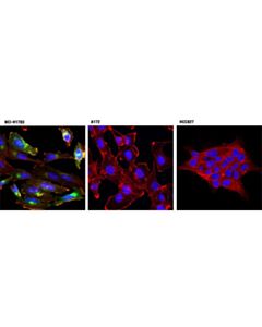 Cell Signaling Pdgf Receptor Alpha (D13c6) Xp Rabbit mAb (Alexa Fluor 488 Conjugate)