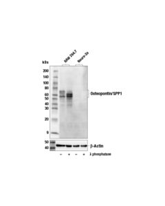 Cell Signaling Osteopontin/Spp1 (E9z1d) Rabbit mAb