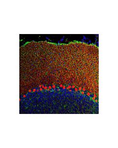 Cell Signaling Calbindin (D1i4q) Xp Rabbit mAb (Alexa Fluor 594 Conjugate)