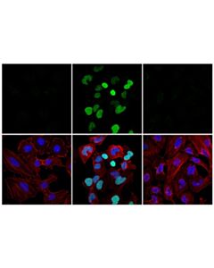Cell Signaling Poly/Mono-ADP Ribose (D9P7Z) Rabbit mAb (Alexa Fluor 488 Conjugate) 100 uL