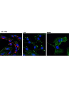 Cell Signaling Pdgf Receptor Alpha (D13c6) Xp Rabbit mAb (Alexa Fluor 555 Conjugate)