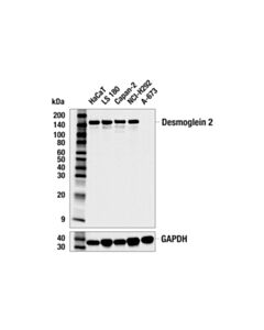 Cell Signaling Desmoglein 2 (8E5) Mouse mAb 20 uL