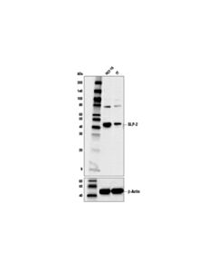 Cell Signaling Slp-2 (D2i9x) Xp Rabbit mAb