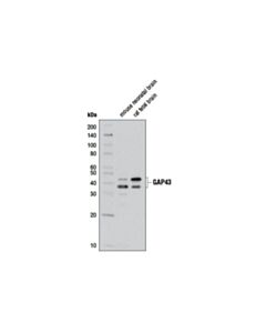 Cell Signaling GAP43 (D9C8) Rabbit mAb 20 uL