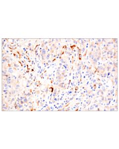 Cell Signaling Timp1 (D10e6) Rabbit mAb