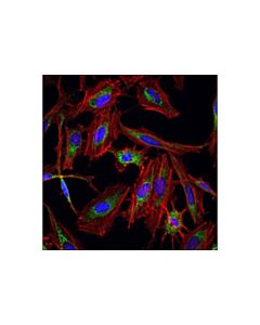 Cell Signaling Alexa Fluor 555 Phalloidin