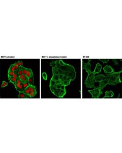 Cell Signaling Phospho-Rb (Ser807/811) (D20b12) Xp Rabbit mAb (Alexa Fluor 555 Conjugate)