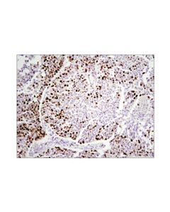 Cell Signaling Ki-67 (D2h10) Rabbit mAb (Ihc Specific)