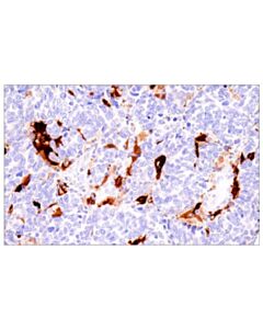 Cell Signaling S100b (E7c3a) Rabbit mAb