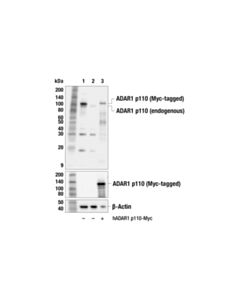 Cell Signaling ADAR1 p110 Isoform (F5F9U) Rabbit mAb