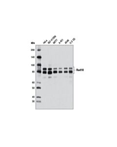 Cell Signaling Rad18 (D2b8) Xp Rabbit mAb
