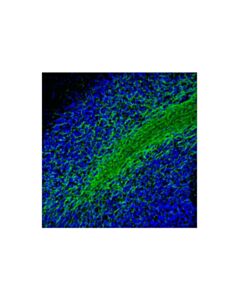Cell Signaling Mag (D4g3) Xp Rabbit mAb