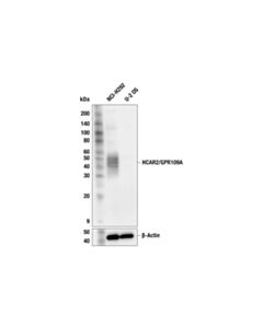 Cell Signaling HCAR2/GPR109A (F6D3M) Rabbit mAb