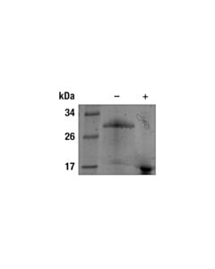 Cell Signaling Human IL-17A Recombinant Protein