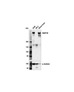 Cell Signaling Map1b (E8s8r) Rabbit mAb