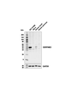 Cell Signaling SERPINB3 (OTI3G4) Mouse mAb