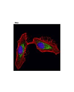 Cell Signaling Prolong Gold Antifade Reagent