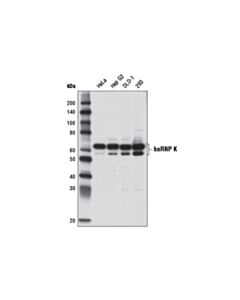 Cell Signaling Hnrnp K (D9a8) Rabbit mAb