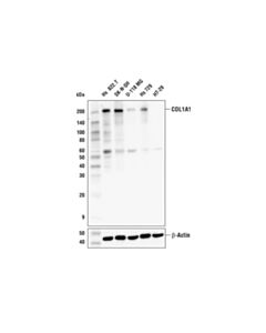 Cell Signaling Col1a1 (E8i9z) Rabbit mAb
