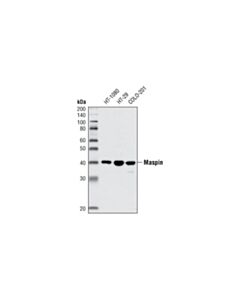 Cell Signaling Maspin (L250) Antibody
