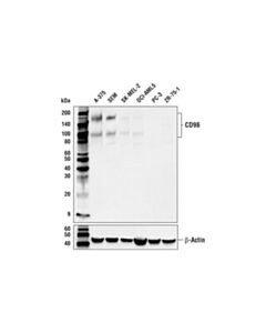 Cell Signaling Cd96 Antibody
