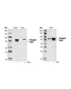 Cell Signaling Phospho-Stat3 (Tyr705) (D3a7) Xp Rabbit mAb
