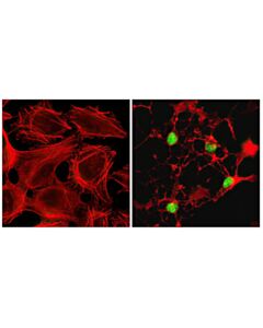 Cell Signaling Cleaved PARP (Asp214) (D64E10) XP® Rabbit mAb (Alexa Fluor® 488 Conjugate); 20 µl