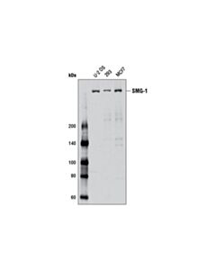 Cell Signaling Smg-1 (D42d5) Rabbit mAb