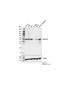 Cell Signaling Cyclin A2 (E1D9T) Rabbit mAb 20 uL