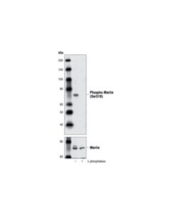 Cell Signaling Phospho-Merlin (Ser518) Antibody