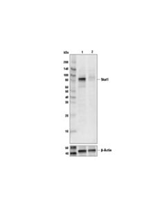Cell Signaling Stat1 (42H3) Rabbit mAb 20 uL