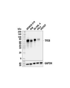 Cell Signaling Tfeb (E4i8r) Mouse mAb