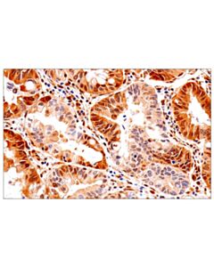 Cell Signaling Pten (D4.3) Xp Rabbit mAb