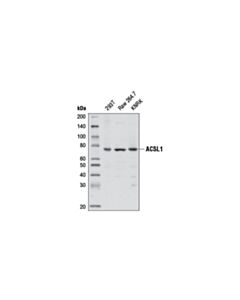 Cell Signaling Acsl1 (D2h5) Rabbit mAb
