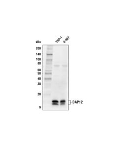 Cell Signaling Dap12 (D7g1x) Rabbit mAb (Biotinylated)