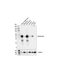 Cell Signaling Doublecortin (E6O6A) Rabbit mAb 20 uL