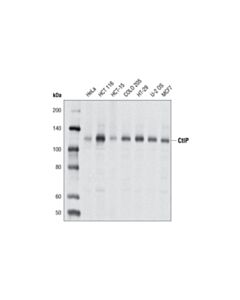 Cell Signaling CtIP (D76F7) Rabbit mAb 20 uL
