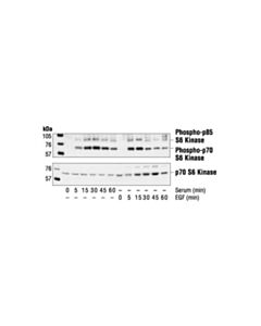 Cell Signaling Phospho-P70 S6 Kinase (Thr421/Ser424) Antibody