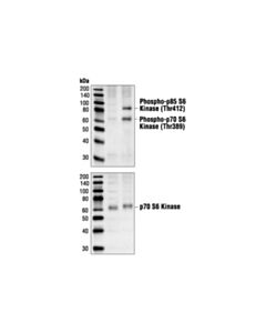Cell Signaling Phospho-P70 S6 Kinase (Thr389) (1a5) Mouse mAb
