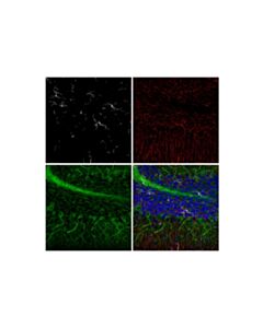 Cell Signaling beta3-Tubulin (D71G9) XP ® Feline Chimeric mAb