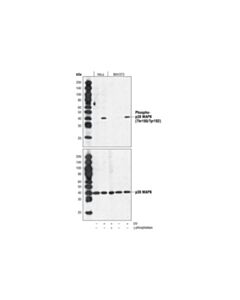 Cell Signaling Phospho-P38 Mapk (Thr180/Tyr182) (28b10) Mouse mAb