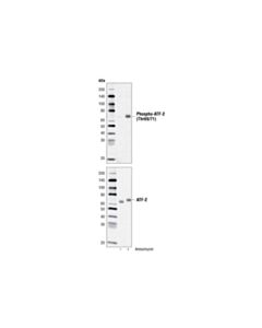 Cell Signaling Atf-2 Control Cell Extracts