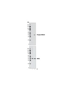 Cell Signaling Mkk3/Mkk6 Control Cell Extracts
