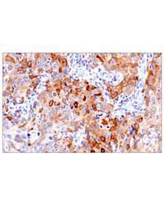 Cell Signaling Asparagine Synthetase (E6c2c) Xp Rabbit mAb