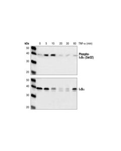 Cell Signaling IkappaBalpha (112B2) Mouse mAb (Carboxy-terminal Antigen) 20 uL