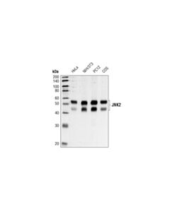 Cell Signaling Jnk2 (56g8) Rabbit mAb