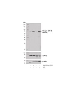 Cell Signaling Phospho-Slp-76 (Ser376) (D7s1k) Rabbit mAb