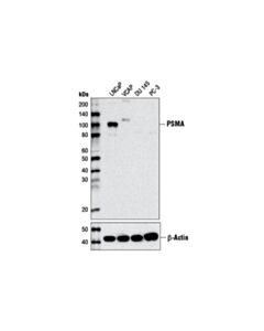 Cell Signaling Prostate Specific Membrane Antigen (D7i8e) Xp ® Rabbit mAb (BSA And Azide Free)