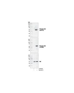 Cell Signaling Akt Control Cell Extracts