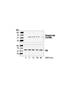 Cell Signaling Phospho-Akt (Thr308) Antibody